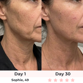 SculptGlow Pro® — 7-in-1 LED Facial Sculptor