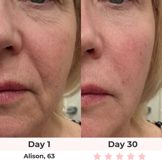 SculptGlow Pro® — 7-in-1 LED Facial Sculptor