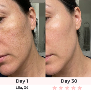 SculptGlow Pro® — 7-in-1 LED Facial Sculptor