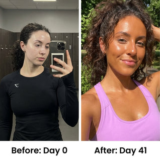 Tanning Gummies - SkinGlow®