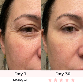 SculptGlow Pro® — 7-in-1 LED Facial Sculptor